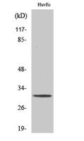 TIMP-3 Polyclonal Antibody