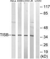 TIS11B Polyclonal Antibody