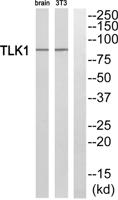 TLK1 Polyclonal Antibody