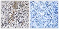 TMC8 Polyclonal Antibody