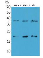 STING/TMEM173 Polyclonal Antibody