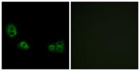 TMEM185A Polyclonal Antibody