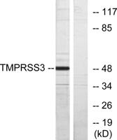 TMPRSS3 Polyclonal Antibody