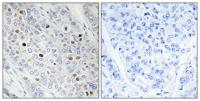 TFIID Polyclonal Antibody