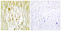 TFIIE-β Polyclonal Antibody