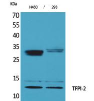 TFPI-2 Polyclonal Antibody