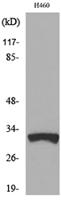 TFPI-2 Polyclonal Antibody