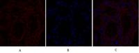 TGFβ RII Polyclonal Antibody