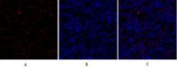 TGFβ RII Polyclonal Antibody