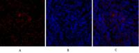 TGFβ RII Polyclonal Antibody