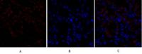 TGFβ RII Polyclonal Antibody