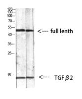 TGFβ2 Polyclonal Antibody