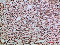 TGFβ2 Polyclonal Antibody