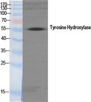 Tyrosine Hydroxylase rabbit pAb