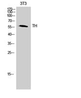 Tyrosine Hydroxylase rabbit pAb