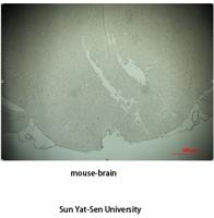 Tyrosine Hydroxylase rabbit pAb