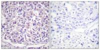 Tyrosine Hydroxylase rabbit pAb