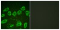 Tyrosine Hydroxylase rabbit pAb