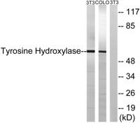 Tyrosine Hydroxylase rabbit pAb