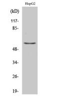 Tyrosine Hydroxylase rabbit pAb