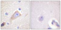 Tyrosine Hydroxylase rabbit pAb