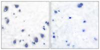 Tyrosine Hydroxylase rabbit pAb