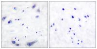 Tyrosine Hydroxylase rabbit pAb