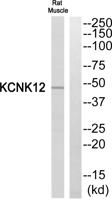 THIK-2 Polyclonal Antibody