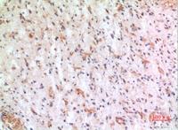 Fractalkine Polyclonal Antibody