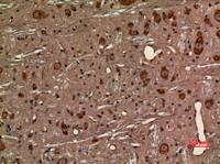 Fractalkine Receptor Polyclonal Antibody