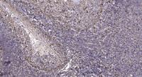 Frizzled-10 Polyclonal Antibody