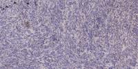 THP Polyclonal Antibody