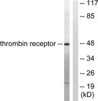 Thrombin R Polyclonal Antibody