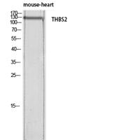 Thrombospondin 2 Polyclonal Antibody