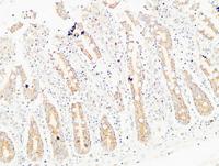 Thrombospondin 2 Polyclonal Antibody