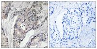 Thrombospondin 4 Polyclonal Antibody