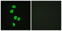 TBC1D4 Polyclonal Antibody