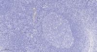 TBK1 Polyclonal Antibody