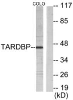 TBX1 Polyclonal Antibody