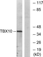 TBX10 Polyclonal Antibody