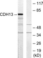 T-cadherin Polyclonal Antibody