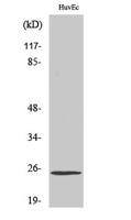 TCEAL6 Polyclonal Antibody