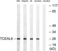 TCEAL6 Polyclonal Antibody