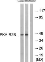 PKA IIβ reg Polyclonal Antibody