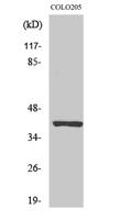 PKAα/β Polyclonal Antibody