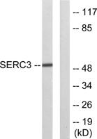 TDE1 Polyclonal Antibody