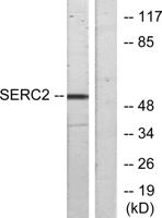 TDE2L Polyclonal Antibody