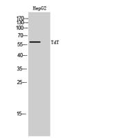 TdT Polyclonal Antibody