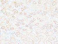 Tenascin-C Polyclonal Antibody