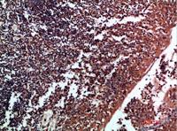 Tenascin-R Polyclonal Antibody